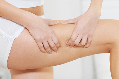 thigh-fat-removal